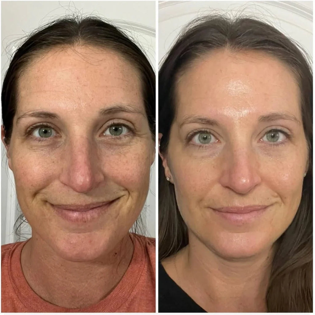 Korean Wrinkle Bounce Multi Balm