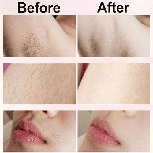 Silky Splash 2-in-1 Facial & Body Shaver