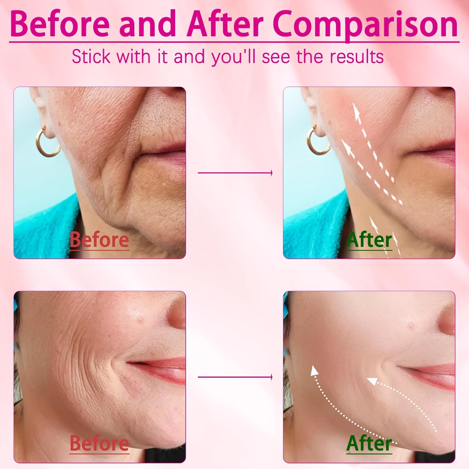 Anti-Wrinkle Face Massager– Anti-Aging Tool