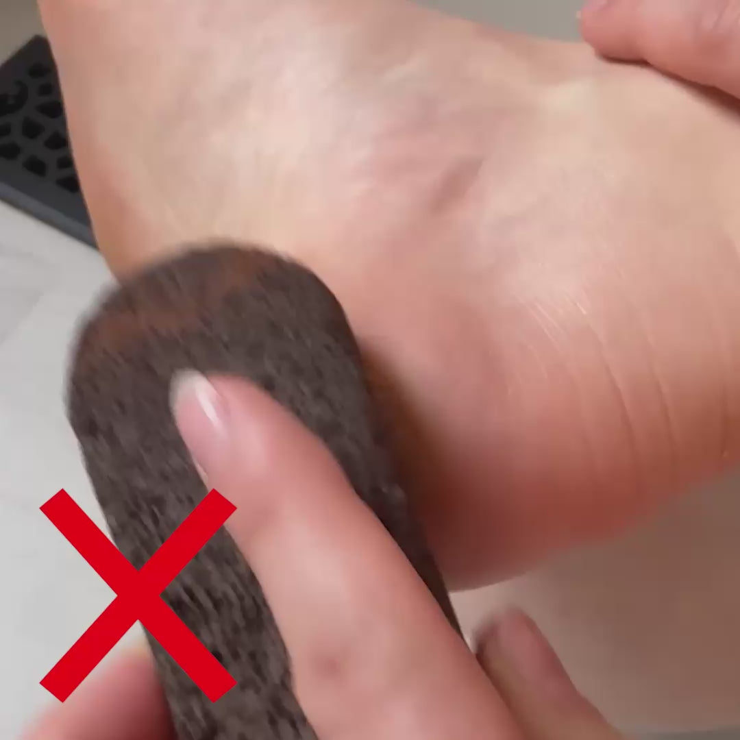 Electric Pedicure Foot File & Callus Remover